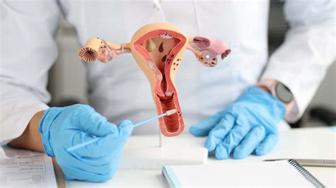 cum se tratează varicele pe colul uterin